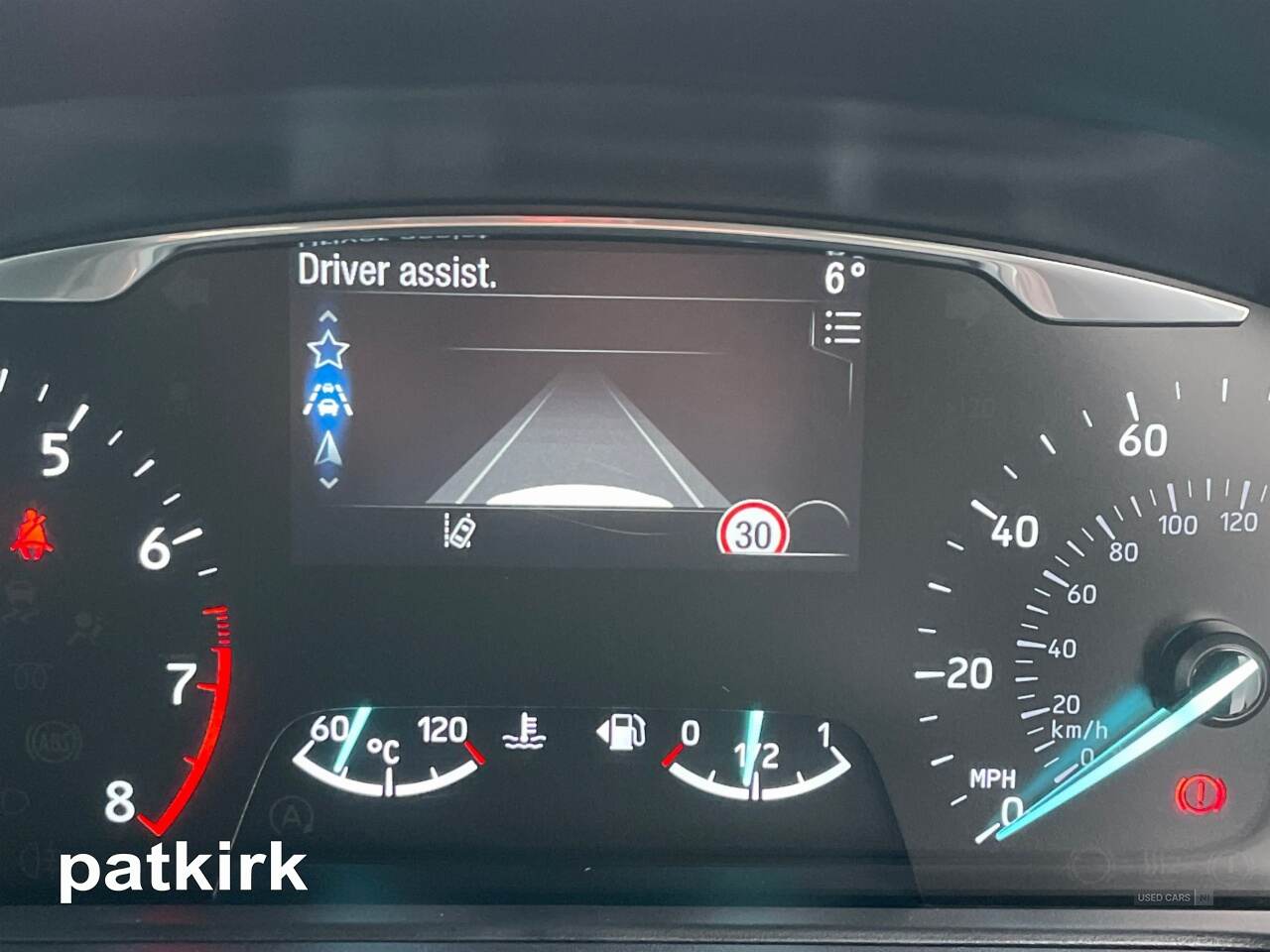 Nov 2020 Ford Fiesta 1.0 EcoBoost 125 Vignale Edition 5dr