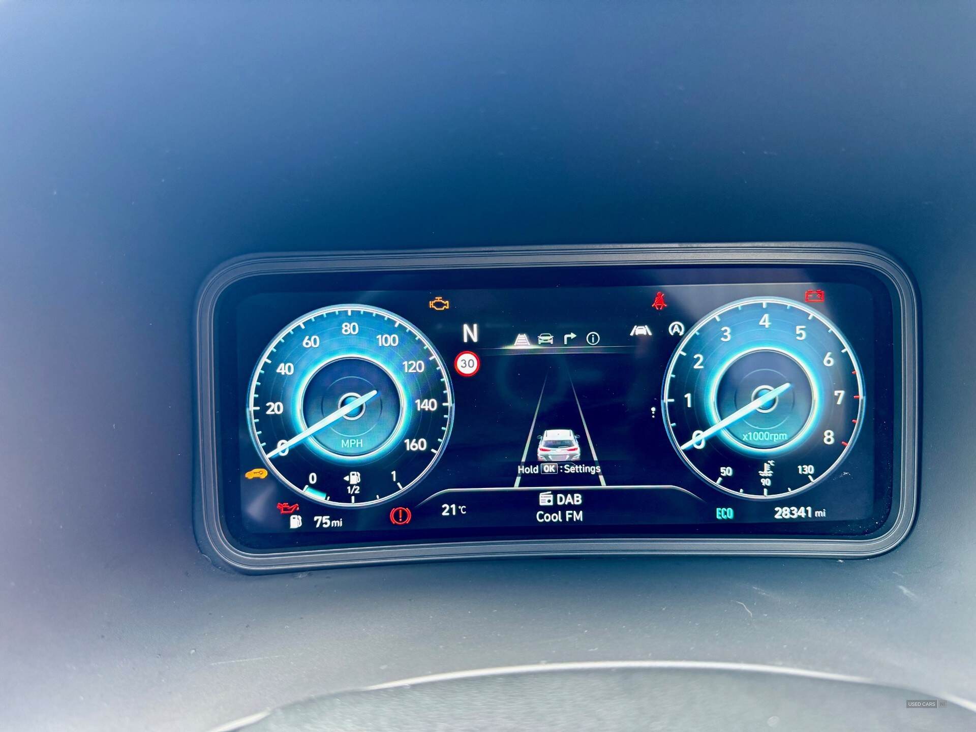 Hyundai Kona HATCHBACK in Down